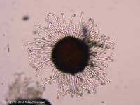 Attēlu rezultāti vaicājumam “Sawadaea tulasnei”