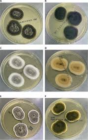 Attēlu rezultāti vaicājumam “Stemonitopsis aequalis var. microspora stalked”