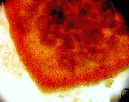 Attēlu rezultāti vaicājumam “Lycogala ustulatum sessile”