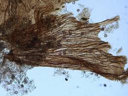 Attēlu rezultāti vaicājumam “Physarum penetrale”