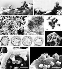 Attēlu rezultāti vaicājumam “Perichaena corticalis spores”