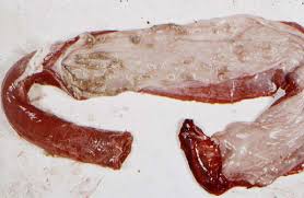 Image result for gangrenous coryza