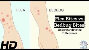 Image result for bed bug bites