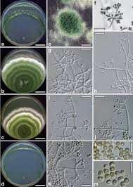 Attēlu rezultāti vaicājumam “Heterotrichia oerstedii (syn. Arcyria oerstedii) macro”