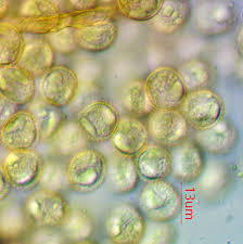 Attēlu rezultāti vaicājumam “Lycogala ustulatum macro”