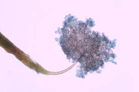 Attēlu rezultāti vaicājumam “Clastoderma debaryanum spores”