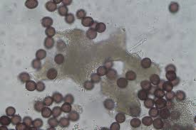 Attēlu rezultāti vaicājumam “Physarum compressum stalked”