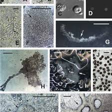 Attēlu rezultāti vaicājumam “Physarum straminipes young”