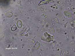 Attēlu rezultāti vaicājumam “Evernia divaricata”