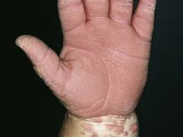 Image result for Lewandowsky-Lutz