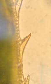 Attēlu rezultāti vaicājumam “Polytrichastrum pallidisetum cells”