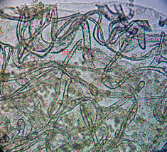 Attēlu rezultāti vaicājumam “Lycogala ustulatum sessile”