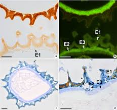 Attēlu rezultāti vaicājumam “Fossombronia wondraczekii spores”