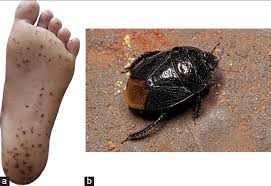 Attēlu rezultāti vaicājumam “Cydnidae”