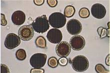 Attēlu rezultāti vaicājumam “Trichia longipalpis spores”