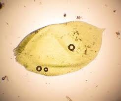 Attēlu rezultāti vaicājumam “Neckera complanata sporophyte”