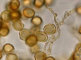 Attēlu rezultāti vaicājumam “Perichaena corticalis macro”