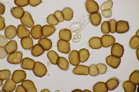 Attēlu rezultāti vaicājumam “Tranzschelia anemones”