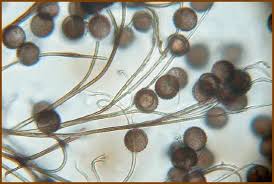 Attēlu rezultāti vaicājumam “Lamproderma gulielmae spores”