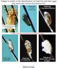 Head Lice Removal Boulder, CO | Lice NITs | Louse Rid Nix
