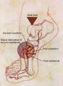 LISFRANC INJURY of the Foot: A Commonly Missed Diagnosis - July ...