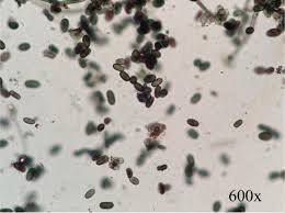 Attēlu rezultāti vaicājumam “Badhamia melanospora spores”