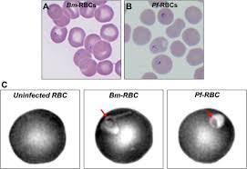 Attēlu rezultāti vaicājumam “Reticularia lobata plasmodium”