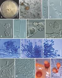 Attēlu rezultāti vaicājumam “Nectria episphaeria”