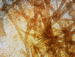 Attēlu rezultāti vaicājumam “Cheilymenia stercorea”