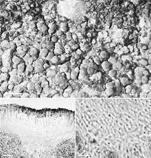 Attēlu rezultāti vaicājumam “Candelariella sp.”