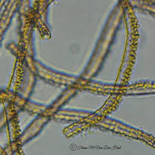 Attēlu rezultāti vaicājumam “Heterotrichia insignis (syn. Arcyria insignis) spores”