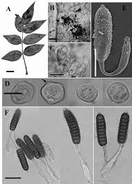 Attēlu rezultāti vaicājumam “Trachyspora intrusa”