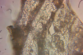 Attēlu rezultāti vaicājumam “Arcyria affinis stalked”