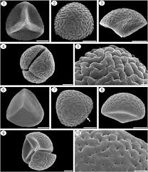 Attēlu rezultāti vaicājumam “Lycogala persicum spores”