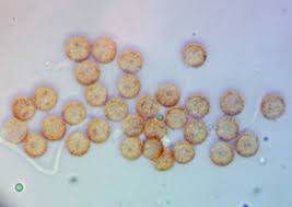 Attēlu rezultāti vaicājumam “Comatricha meandrispora”