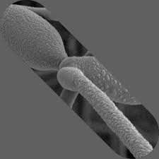 Attēlu rezultāti vaicājumam “Arcyria, Heterotrichia sp.”