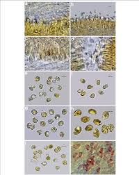 Attēlu rezultāti vaicājumam “Badhamia affinis var. microspora spores”