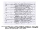 contra la <b>Epilepsia</b>,