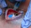 Eyeball Tattoos Could Become a Crime [