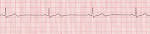 12 Lead EKG Interpretation Part #2 « Desi77's Blog