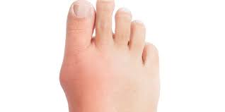 Znalezione obrazy dla zapytania palec