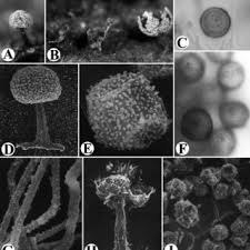 Attēlu rezultāti vaicājumam “Diachea leucopodia spores”