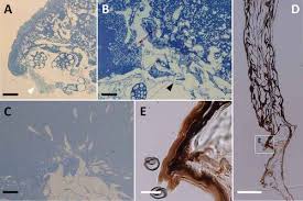 Attēlu rezultāti vaicājumam “Lamproderma arcyrioides stalked”
