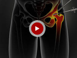 Attēlu rezultāti vaicājumam “Cribraria piriformis”