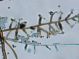 Attēlu rezultāti vaicājumam “Blepharostoma trichophyllum sporophyte”