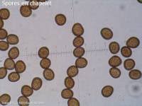 Attēlu rezultāti vaicājumam “Badhamia utricularis spores”