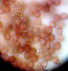 Attēlu rezultāti vaicājumam “Diderma rufostriatum young”
