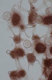 Attēlu rezultāti vaicājumam “Cribraria microcarpa spores”