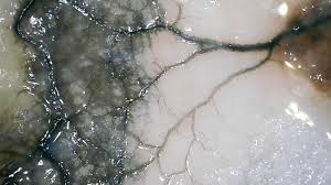 Attēlu rezultāti vaicājumam “Metatrichia vesparia”