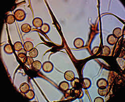 Attēlu rezultāti vaicājumam “Symphytocarpus flaccidus plasmodium”